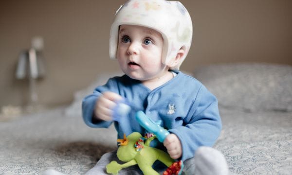 Jeune enfant portant un casque pour la plagiocéphalie