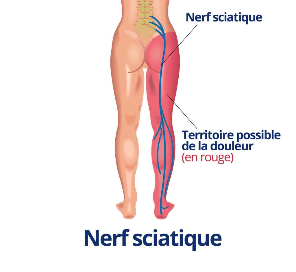 https://lifemag-ci.com/le-remede-maison-contre-la-douleur-du-nerf-sciatique/