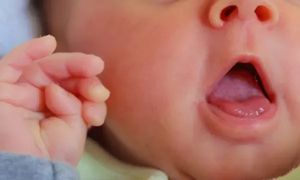 Apnée du sommeil chez l'enfant